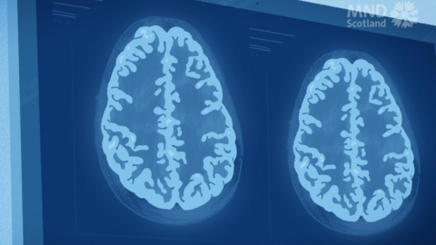 Brain scans on wall
